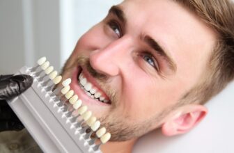 Is Teeth Whitening Safe? Expert Opinions You Need to Hear