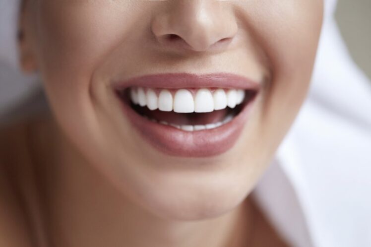 whiter smiles