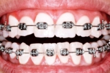 Crafting Perfect Smiles: The Art and Science Behind Orthodontics