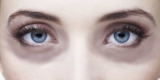 Dark circles quick home remedies